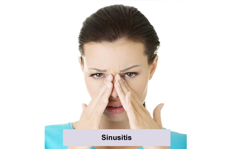 Sinusitis