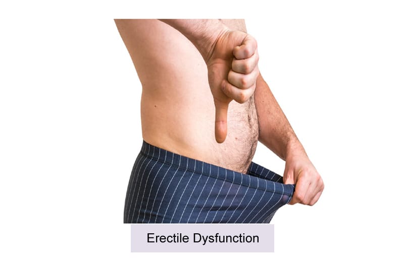 Erectile Dysfunction