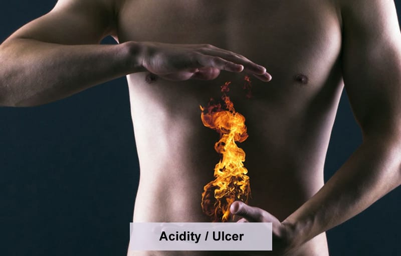 Acidity / Ulcer